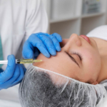 Armonización Facial con Ácido Hialurónico